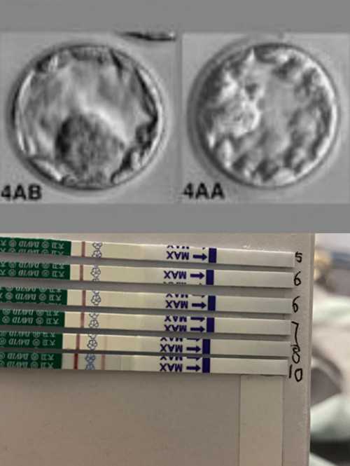 有想做代孕妈妈的吗,美国试管婴儿技术怎么样(掌握这三点一胎*女宝也不难)